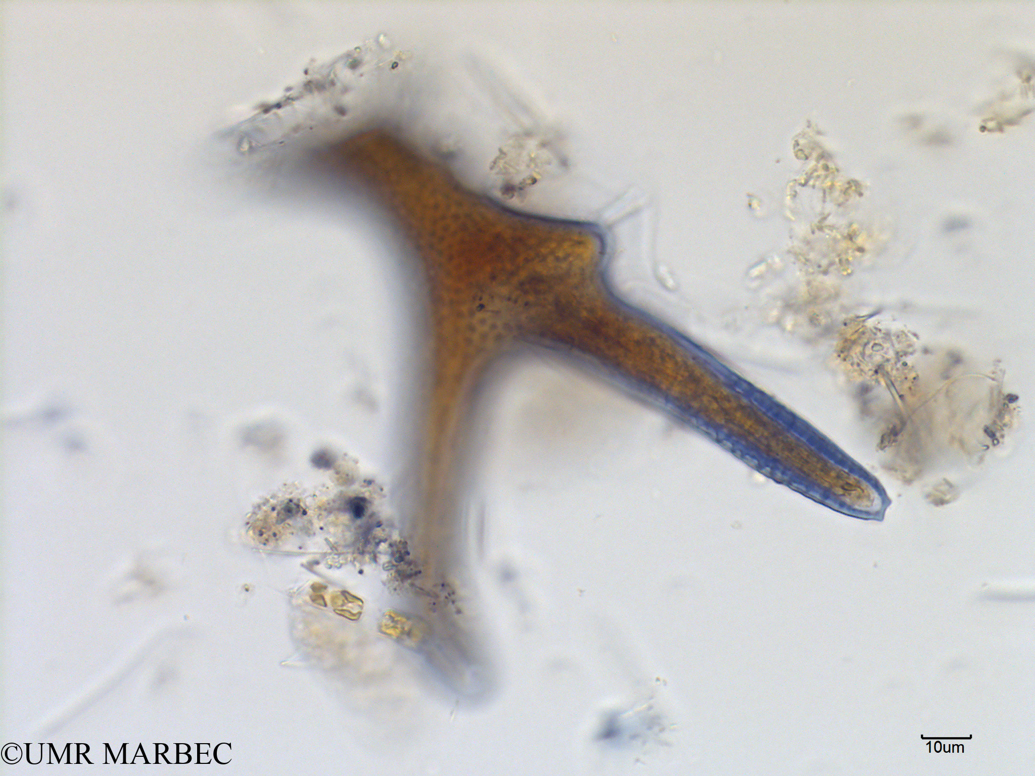 phyto/Scattered_Islands/mayotte_lagoon/SIREME May 2016/Dinophysis miles (MAY8_dino a identifier-9).tif(copy).jpg
